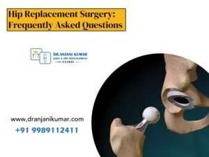 Read more about the article Hip Replacement Surgery: Frequently Asked Questions