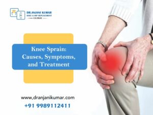 Read more about the article Knee Sprain: Causes, Symptoms, and Treatment