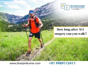 Read more about the article How long after ACL surgery can you walk?