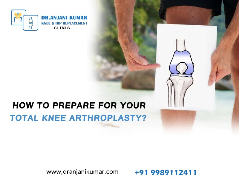 Read more about the article How to prepare for your total knee arthroplasty?