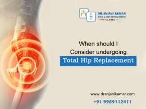 Read more about the article When should I consider undergoing a total hip replacement?
