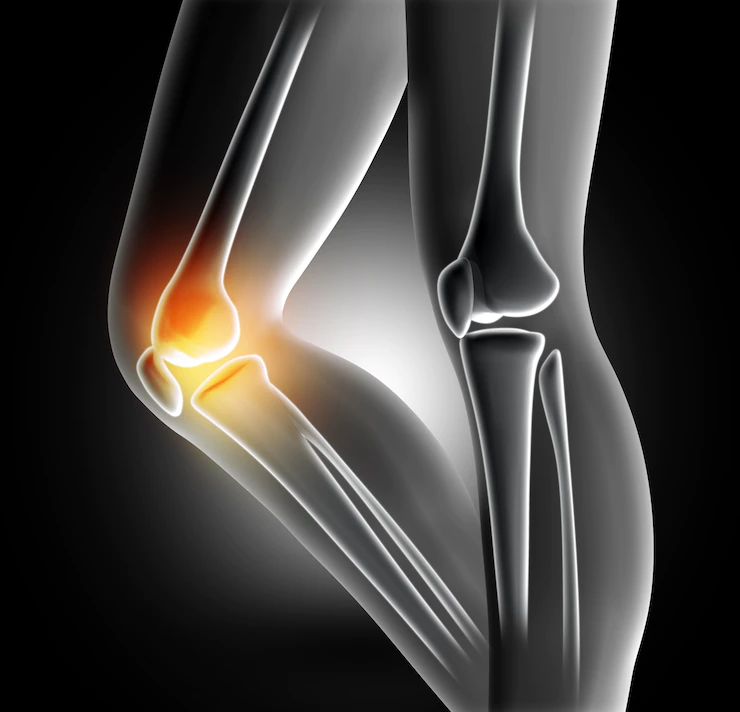 Get today Best Knee injuries Treatment in Hyderabad by Dr Anjani Kumar, Orthopaedic Specialist in Hyderabad