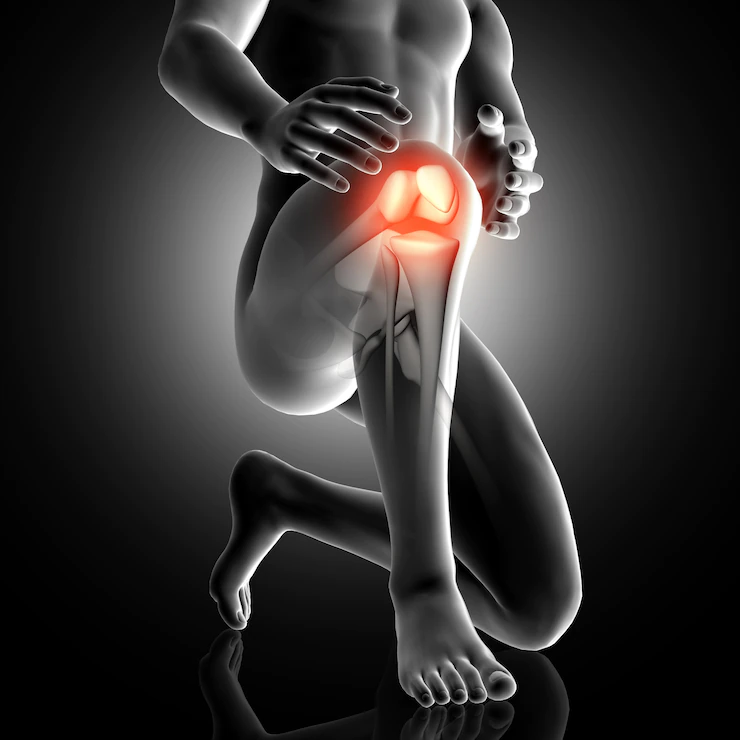 Knee Treatment In Hyderabad, Orthopaedic Specialist near me for Knee pain