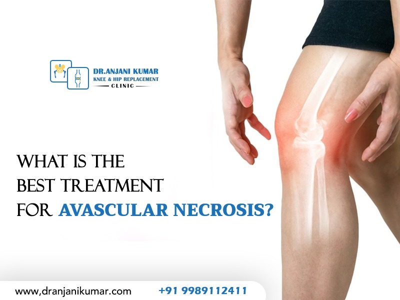 Read more about the article What is the best treatment for avascular necrosis?