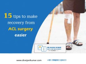 Read more about the article 15 tips to make recovery from ACL surgery easier