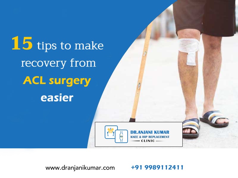 You are currently viewing 15 tips to make recovery from ACL surgery easier