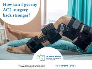 Read more about the article How can I get my ACL surgery back stronger?