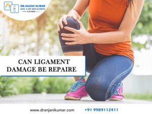 Read more about the article Can ligament damage be repaired?
