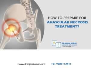 Read more about the article How to prepare for avascular necrosis treatment?