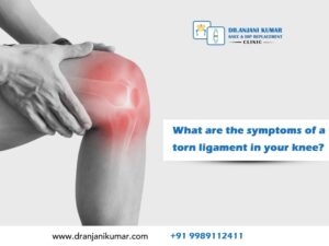 Read more about the article What are the symptoms of a torn ligament in your knee?