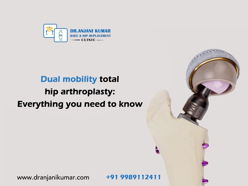 Read more about the article Dual mobility total hip arthroplasty: Everything you need to know