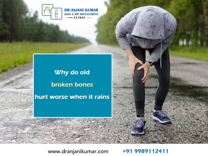 Read more about the article Why do old broken bones hurt worse when it rains