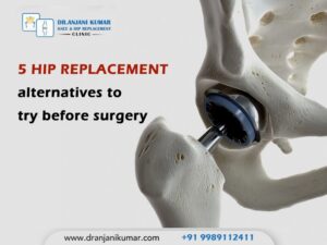 Read more about the article 5 hip replacement alternatives to try before surgery